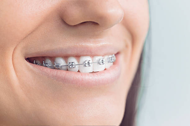 Best Veneers and Lumineers  in Crystal Lawns, IL